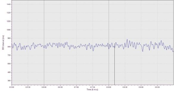 Non-athlete Tachogram